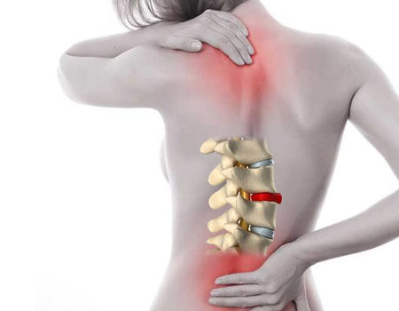 La Quiropráctica puede dar una solución a la hernia discal mediante un ajuste vertebral seguro y eficaz.